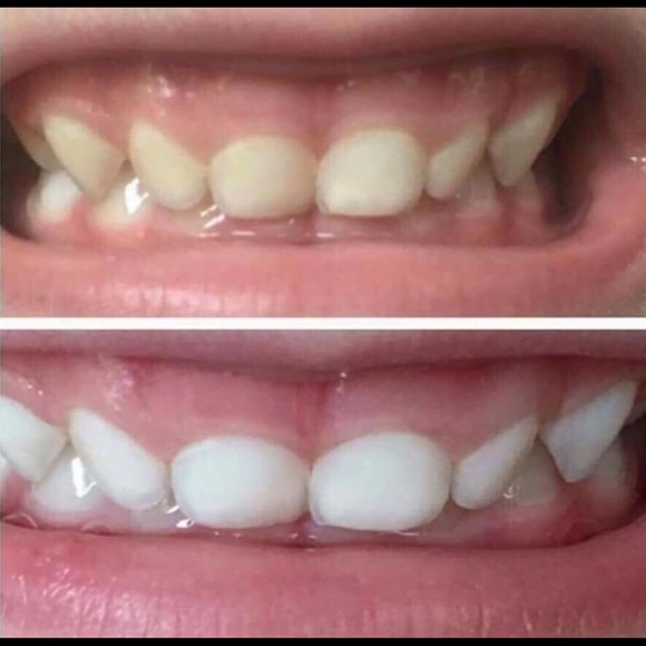Whitening Toothpaste - Picture 6 of 6
